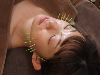 アキュリング(Aculing)の写真/豊富な鍼メニューからむくみ,たるみケア,リフトUP,ハリ,潤いなど…効果別のクーポン多数ご用意★