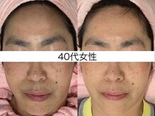 サクラ 本厚木駅前店(SAKURA)/【本厚木/相模原/伊勢原】