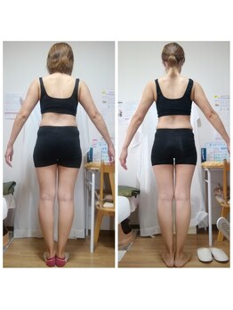 ノーリーン(NOLEEYN)/39歳　1ヶ月　-4.5ｋｇ☆