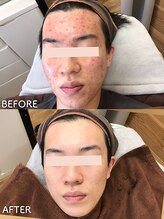 ビアンカ/お客様のお声