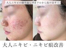 エピア 豊田店(Epia)