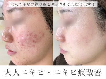 エピア 豊田店(Epia)