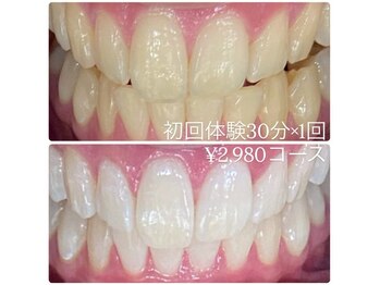 ホワイトニングルーム 川崎店(WhiteningRoom)/ホワイトニング/川崎