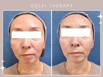 シロカネ 光の森店(SHIROKANE)/韓国式小顔コルギ☆