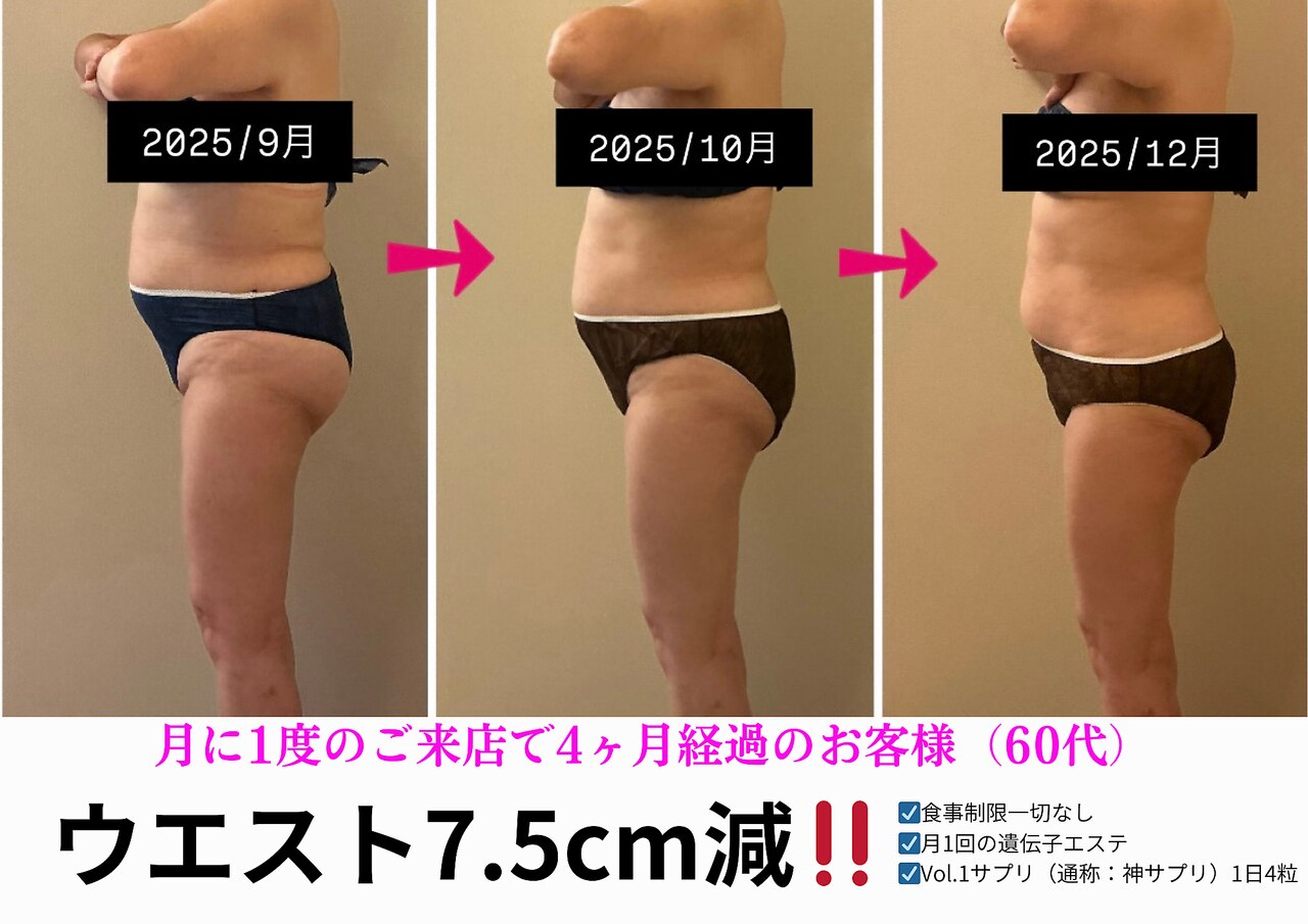 エーシーサロン 六本木店(acsalon)｜ホットペッパービューティー