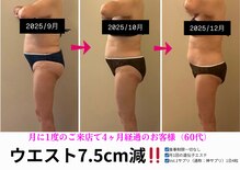 エーシーサロン 六本木店(acsalon)