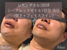 マイスター整体院 天神院