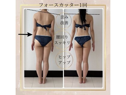 レアーレグロウ(Reale Glow)の写真