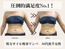 アオレニア(ao.lenia)の雰囲気（圧倒的満足度No.1★漢方オイルx痩身）