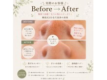 エミア(Emia)