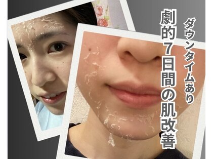 リオル(Rior)の写真