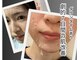 リオル(Rior)の写真