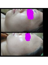 ビューティースリム タニダ/