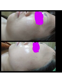 ビューティースリム タニダ/