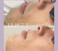 フォルチェ 神辺店(Folche)