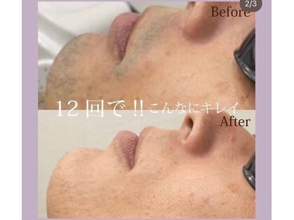 フォルチェ 神辺店(Folche)の写真