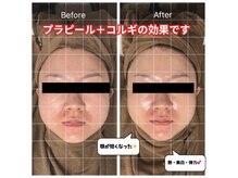 チョアチョア 札幌すすきの店(CHOA-CHOA)の雰囲気（気になっていた左右差も当店のコルギでお悩み解消☆【コルギ】）