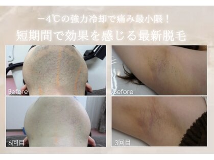 ルミナ(Lumina)の写真