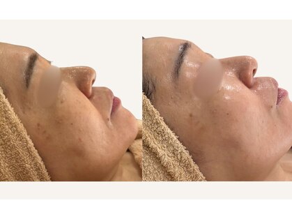 グロウスキン(GROW SKIN)の写真