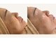 グロウスキン(GROW SKIN)の写真