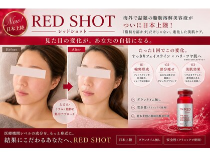 カノン(Kanon)の写真