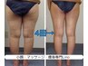【痩身】太もも足首が気になる方へ!痩身マシン+アロマリンパ30分¥4000