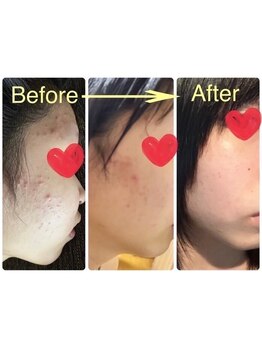 ヨサパーク クレオメ(YOSAPARK Cleome)/お肌も陶器のようにツルスベに！