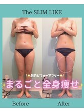 スリムライク 鳥取店(The SLIM LIKE)/痩身ビフォーアフター