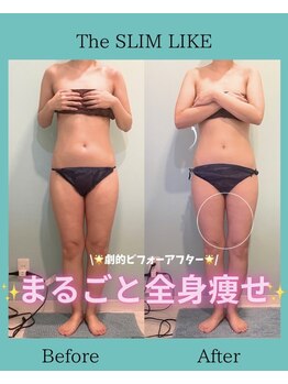スリムライク 鳥取店(The SLIM LIKE)/痩身ビフォーアフター