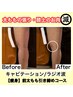 【前太ももハリ/膝まわり】前太ももすっきりコース40分¥4,500
