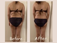 レモン(Lemon)/ビフォーアフター