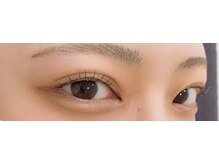 ビート(BEAT)/マツパ