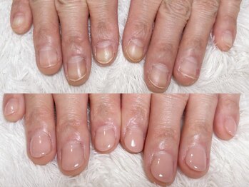 グラシナ 鳥丸店/(深爪/長さだし/フィルイン/)