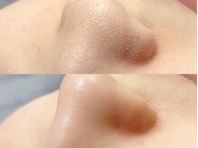 アンドアルファ 仙台(&α)/美眉/眉毛/アイブロウ/仙台