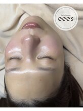 イーズ(eees)/ウルツヤ毛穴ケア9回目のお客様