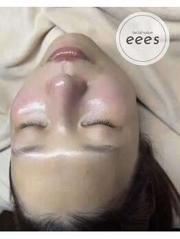 イーズ(eees)/ウルツヤ毛穴ケア9回目のお客様