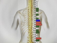 オレンジカイロプラクティック/サーモグラフィー