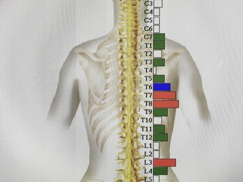 オレンジカイロプラクティック/サーモグラフィー