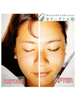 オリーヴァ 大船/≪フェイシャル≫