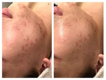 スターエステ(STAR ESTHE)/【ビフォーアフター】