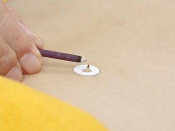 よしだ鍼灸整骨院 整体院/お灸をしている所【鍼灸施術】