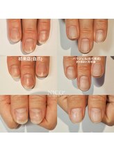 ニコプラス(NICO+)/自爪育成中