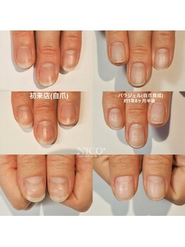 ニコプラス(NICO+)/自爪育成中