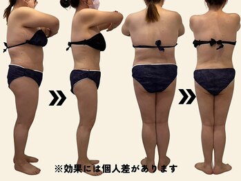 エルソル(elsol)/9ヶ月コース