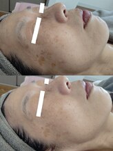 ビーユー(Be.you)/肌のトーンアップ…♪