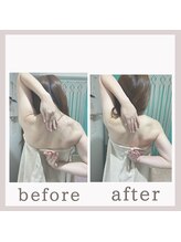 アリサナ(Arisana)&nbsp;症例写真 首肩腰