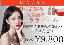 コンフィデンス(Confidence)