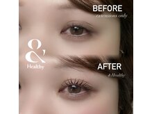 ベル(Belle)/&Healthy ビフォーアフター