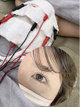 ビラ ベルダ(Bira Beldad)の写真/毛穴の開き、くすみ、乾燥改善☆次世代まつ毛パーマとのsetクーポンでお得に☆【特別価格¥11600→¥8800】