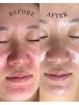 ジェルム(germe.)/リピート様続出★赤み鎮静ケア